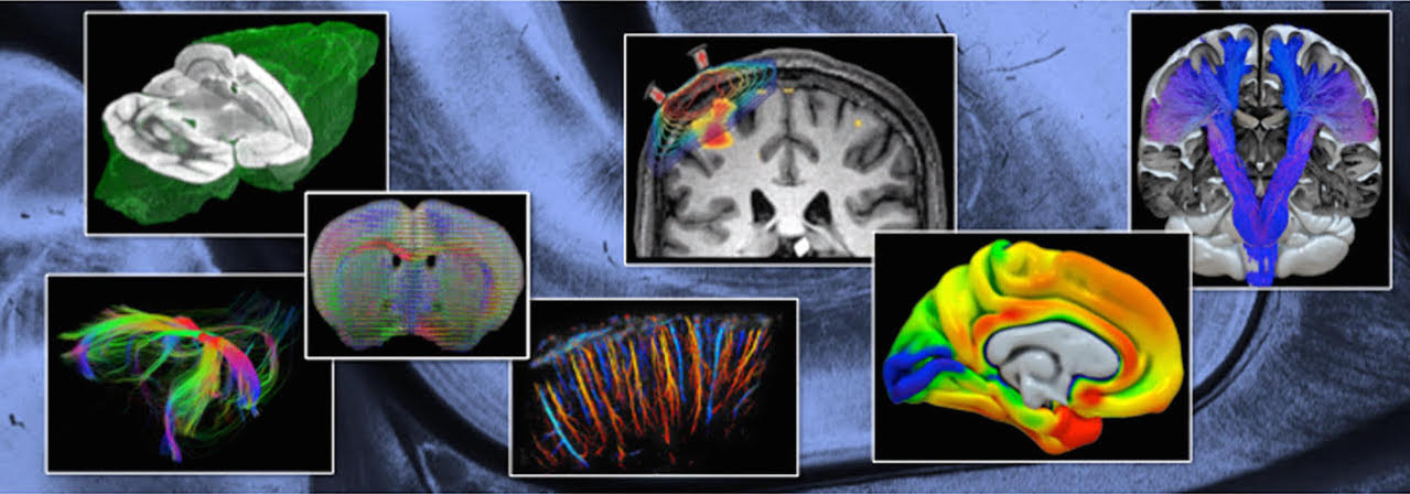 Whole brain imaging - Bordeaux school of neuroscience
